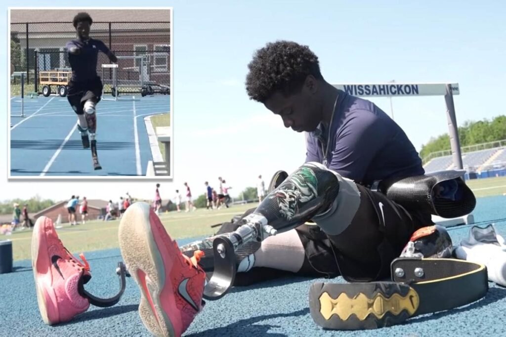 Teen with no arms or legs chases dream of running in the Paralympics as one of few quadruple amputee competitors Teen with no arms or legs chases dream of running in the Paralympics as one of few quadruple amputee competitors