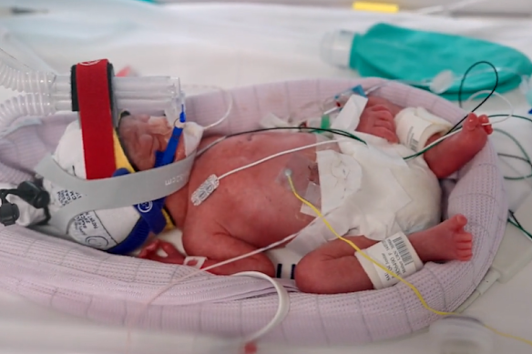 The four girls – Emily, Harriet, Alexa and Catherine – were delivered via caesarean section.
