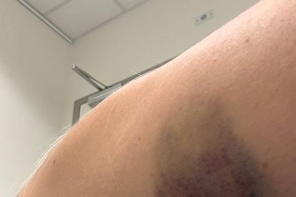 Which way on a two-street caused this?