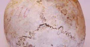 Skull found in 1975 belongs to Uxbridge, Ont. WWI veteran: police Skull found in 1975 belongs to Uxbridge, Ont. WWI veteran: police