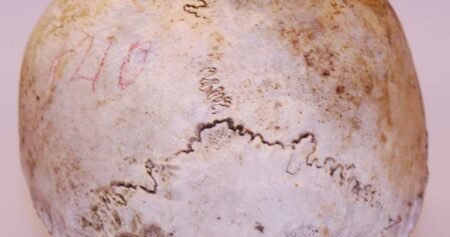 Skull found in 1975 belongs to Uxbridge, Ont. WWI veteran: police Skull found in 1975 belongs to Uxbridge, Ont. WWI veteran: police