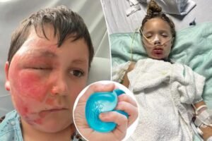 Doctors issue warning over massively popular toy that’s hospitalizing children with excruciating injuries Doctors issue warning over massively popular toy that’s hospitalizing children with excruciating injuries
