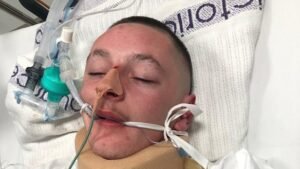 Gippsland police accused of repeat misconduct after one victim suffers brain damage Gippsland police accused of repeat misconduct after one victim suffers brain damage