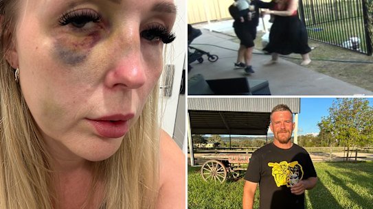 Chloe Wright was assaulted by her ex-partner, who has since been granted bail as he awaits sentencing.