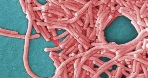 TTC cooling tower is source of Toronto legionnaires’ outbreak: public health TTC cooling tower is source of Toronto legionnaires’ outbreak: public health