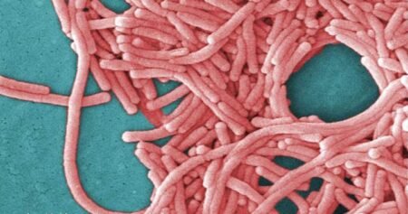TTC cooling tower is source of Toronto legionnaires’ outbreak: public health TTC cooling tower is source of Toronto legionnaires’ outbreak: public health