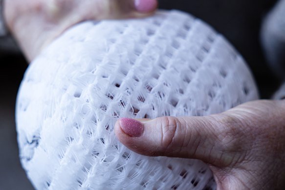 The 3D-printed scaffold uses fat cells to replace breast implants.