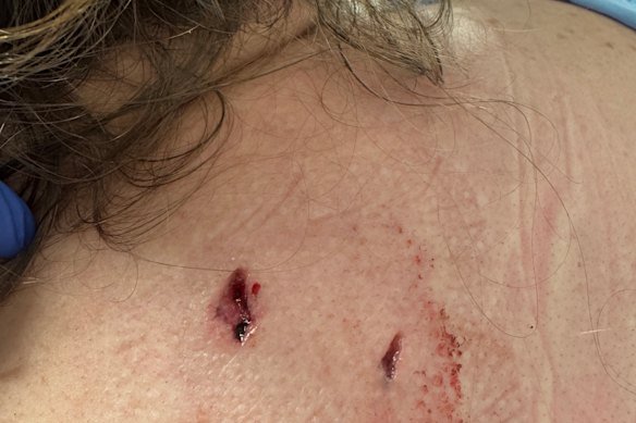 Cherie Holt was stabbed in the back and neck with scissors.