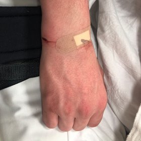 Kellie said her son’s wrist was also injured by the handcuffs.