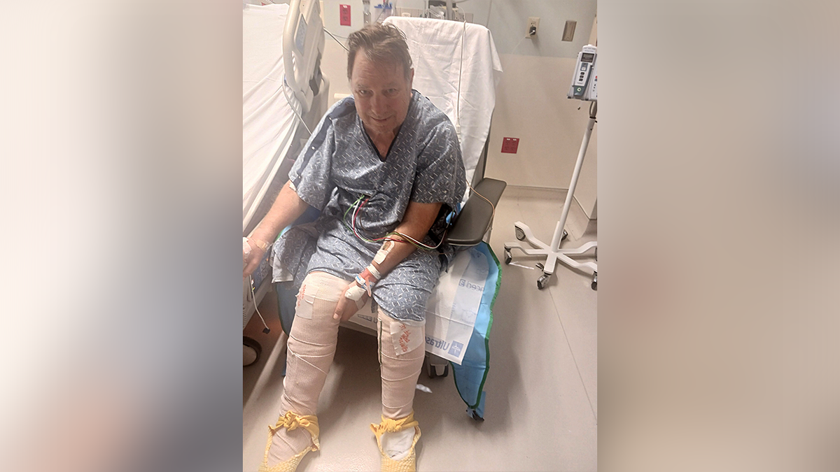Grant Siler suffered severe burns after falling