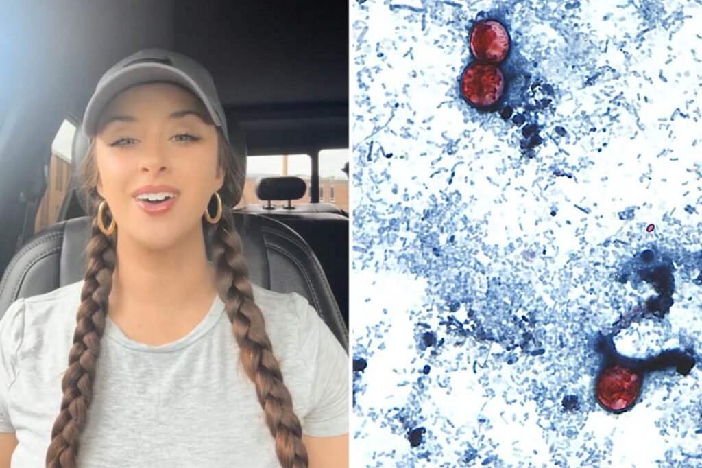 TikTok food critic, 29, details ‘miserable’ experience of contracting ‘explosive diarrhea’ parasite TikTok food critic, 29, details ‘miserable’ experience of contracting ‘explosive diarrhea’ parasite