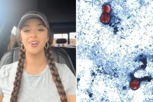 TikTok food critic, 29, details ‘miserable’ experience of contracting ‘explosive diarrhea’ parasite TikTok food critic, 29, details ‘miserable’ experience of contracting ‘explosive diarrhea’ parasite