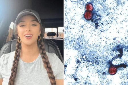 TikTok food critic, 29, details ‘miserable’ experience of contracting ‘explosive diarrhea’ parasite TikTok food critic, 29, details ‘miserable’ experience of contracting ‘explosive diarrhea’ parasite