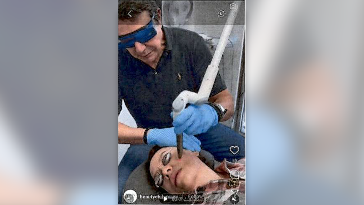 someone performing a laser face lift