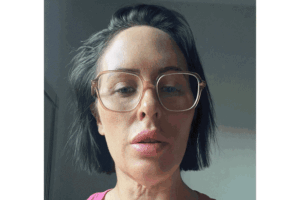 The gory social media trend fuelling a surge in cosmetic tourism in Turkey