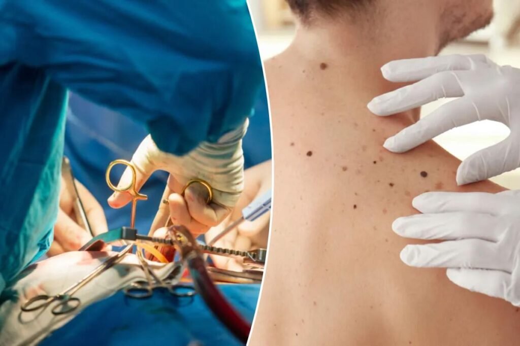 Heart surgery cured a man’s skin cancer — but left him with a bizarre new condition Heart surgery cured a man’s skin cancer — but left him with a bizarre new condition