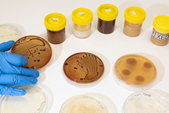 A range of new antibiotic approaches are under investigation, yet reliant on dwindling funding.