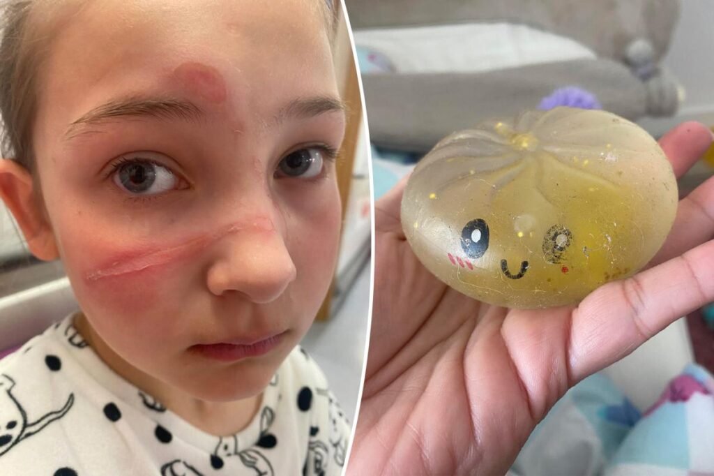 Popular squishy toy recalled over ‘serious injury’ hazard after months of child hospitalizations Popular squishy toy recalled over ‘serious injury’ hazard after months of child hospitalizations