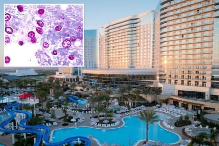 Highly contagious SoCal parasite outbreak linked to .3B resort pools under investigation Highly contagious SoCal parasite outbreak linked to .3B resort pools under investigation