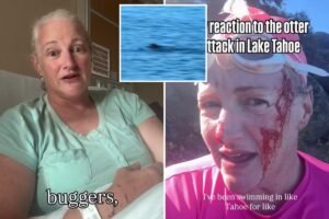 Lake Tahoe swimmer attacked by ‘ruthless’ otter undergoes surgery