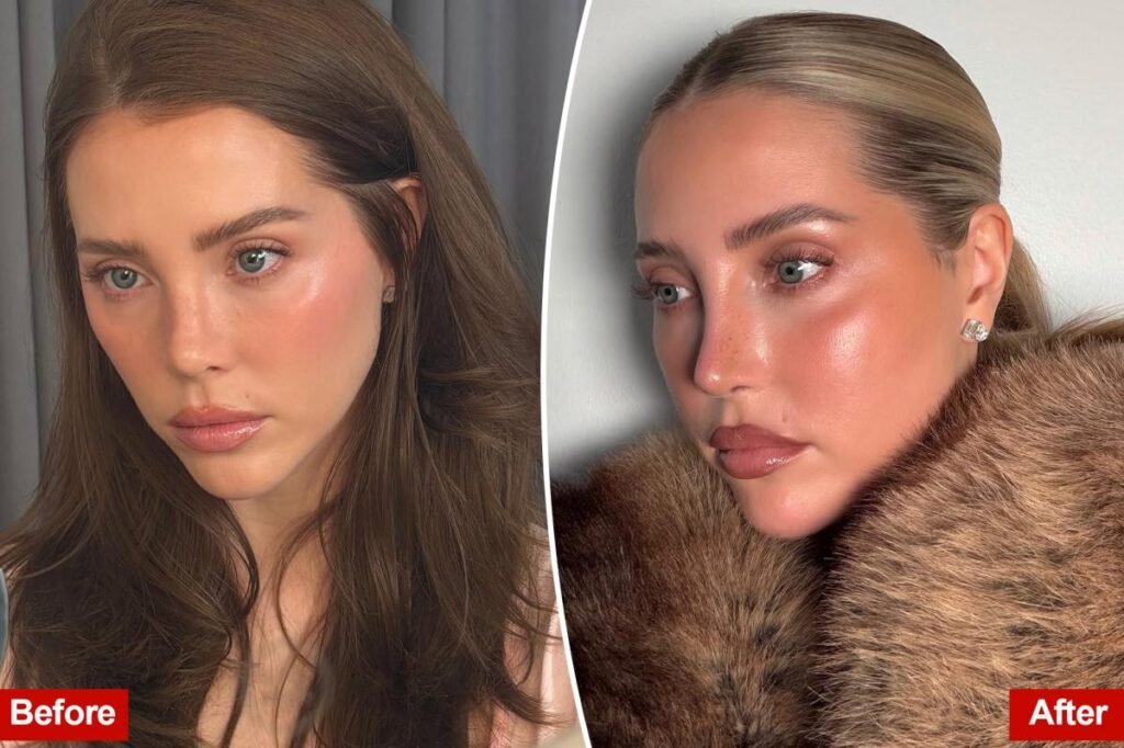 Why This Beauty Influencer Tried to Hide Her ,000 Beverly Hills Nose Job Why This Beauty Influencer Tried to Hide Her ,000 Beverly Hills Nose Job