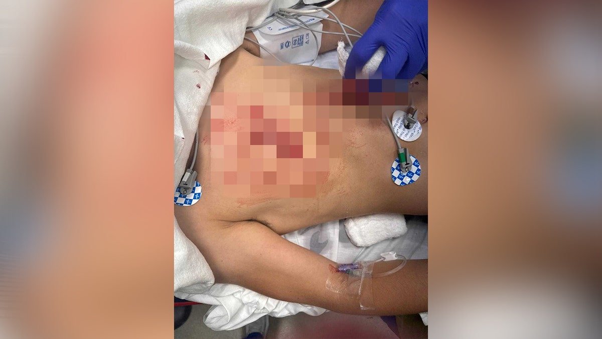 injuries to chest as doctors examine patient