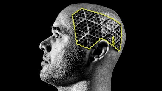 Fluent research participant Lachlan Hill wears an electrode array that can match brain activity to basic phrases.