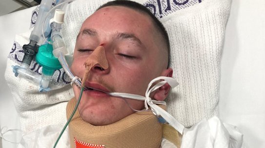 Brodie Holt was placed in an induced coma after an alleged violent assault by police outside the Traralgon Hotel. 