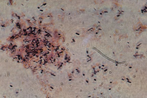 Clostridioides difficile under the microscope. 