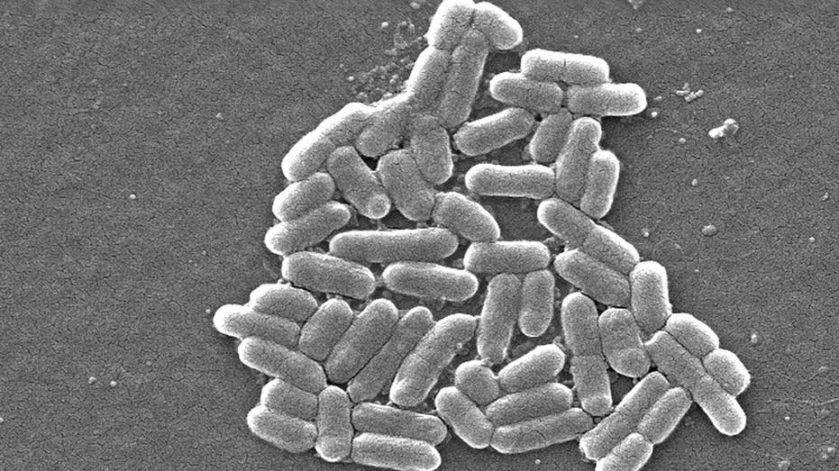 ecoli under microscope