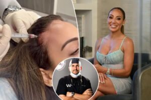 I restored Melissa Gorga’s thinning hairline — here’s exactly how I helped grow her locks back