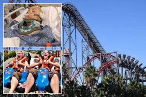 LA lawyer says Magic Mountain’s X2 coaster left him brain damaged after day out with grandkids LA lawyer says Magic Mountain’s X2 coaster left him brain damaged after day out with grandkids